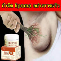 Lipoma removal cream ครีมก้อนเนื้องอกไขมัน ครีมทาเนื้องอกไขมัน 30g กำจัดปัญหาใต้ผิวหนัง ก้อนไขมันแข็ง เนื้องอกไขมัน สมุนไพรกำจัด ก้อนเนื้อใต้ผิ