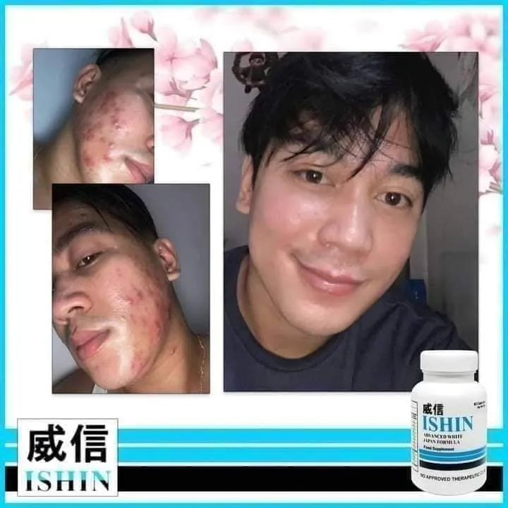 iSHIN ADVANCED 10X WHITENING JAPAN FORMULA with COLLAGEN (60 GLUTA