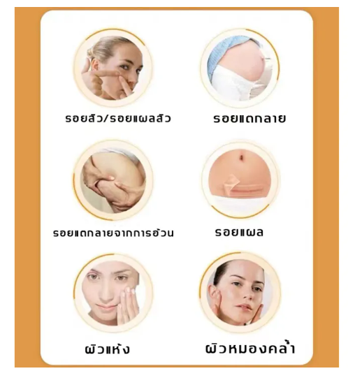 bio-oil-ไบโอ-ออยล์-200มล-ช่วยเรื่องรอยแผลเป็น-รอยแตกลาย-และปัญหาผิวแห้ง