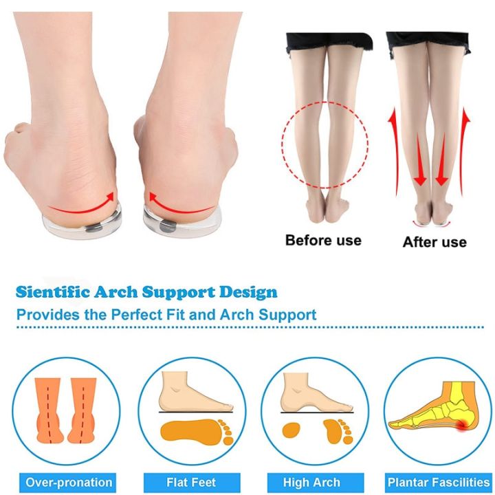 2-pcs-professional-arch-orthotic-support-insole-foot-plate-flatfoot-corrector-shoe-cushion-foot-care-insert-insoles-silicone-gel-shoes-accessories
