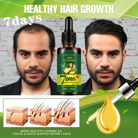 Ready Stock Hair growth oil 30ml 100% natural gingerprevents hair loss and promotes hair growth Ready Stock Hair growth oil 30ml 100% natural gingerprevents hair loss and promotes hair growth