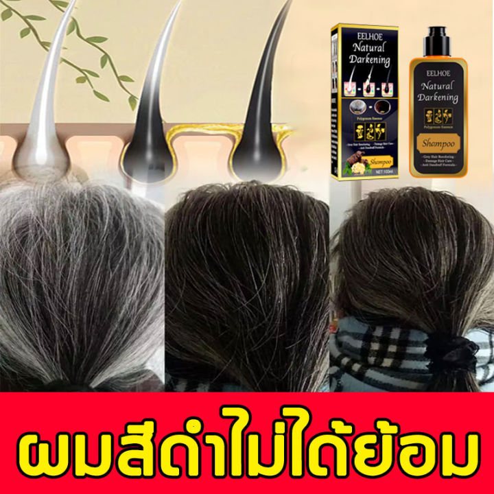 สระแล้วบอกลาผมขาวได้ Eelhoe แชมพูแก้ผมหงอก สารสกัดจากสมุนไพร ผมขาวหลังคลอด  ผมขาววัยกลางคนและวัยสูงอายุ สารสกัดจากสมุนไพร ไม่ต้องย้อม （แชมพูเหอโส่วอู  แชมพูสระผมหงอก แชมพูสมุนไพรจีน ยาสระผมสมุนไพร ผมหงอกกลับมาดำ แชมพูปิดผมหงอก  แชมพูปิดหงอก ย้อมผมสีดำ ...