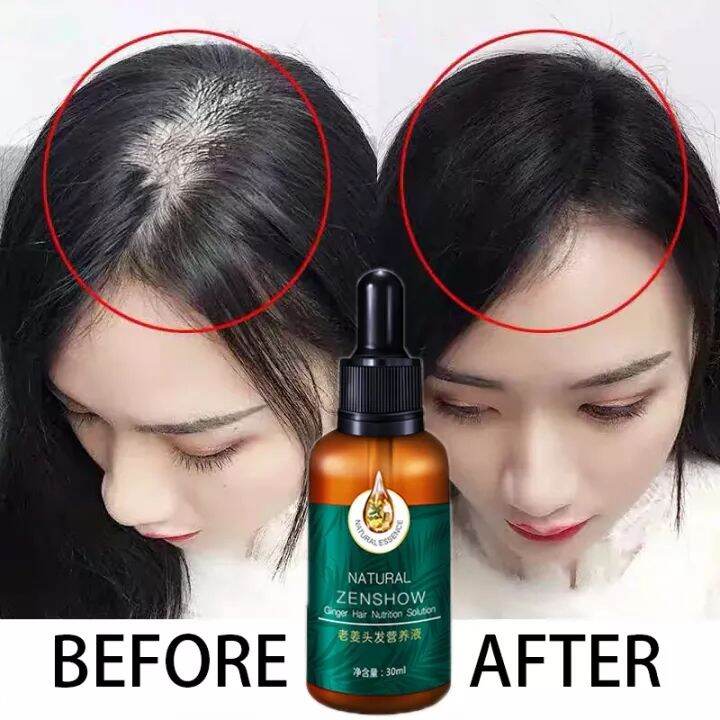 Hair Growth For Men And Women Anti Hair Loss Spray Hair Treatment Hair Growth For Men And Women Anti Hair Loss Spray Hair Treatment