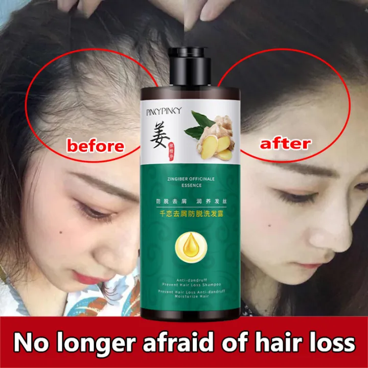 Ginger shampoo prevents hair loss, hair increase, dense growth hair