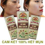 Kem giảm mụn thâm sẹo rỗ An Dược Sơn - Chai 30ml