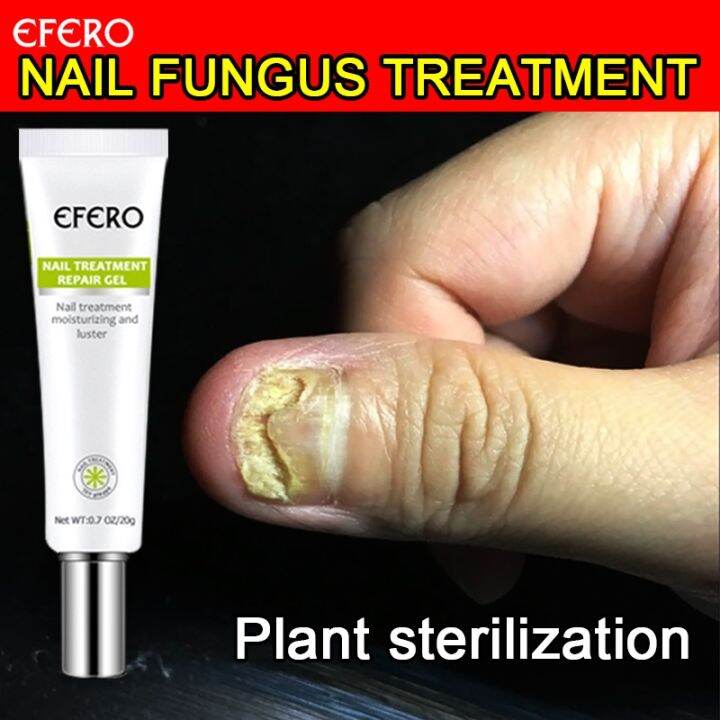 [Repair rotten nails]EFERO Nail Repair Cream 20g , restore smooth nails（Nail treatment serum