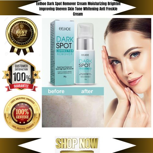 TOP SELLING !! Eelhoe Dark Spot Remover Cream Moisturizing Brighten  Improving Uneven Skin Tone Whitening Anti Freckle Cream Melasma Acne Age  Spot Melanin Pigment Corrector Liquid Expelling Toxins From Pores Softens  Facial