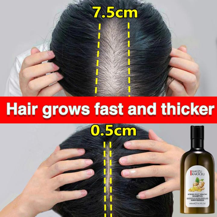 Hair tonic for hair growth hair recipe shampoo Care and nourish hair Increase hair quantity 400ml Strong hair roots Reject split ends Hair quality is frizzy | Lazada Hair tonic for hair growth hair recipe shampoo Care and nourish hair Increase hair quantity 400ml Strong hair roots Reject split ends Hair quality is frizzy | Lazada