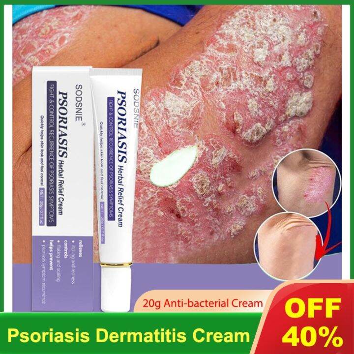 Herbal Psoriasis Dermatitis Cream Effective Antibacterial Anti Itch Relief Eczema Body Ointment