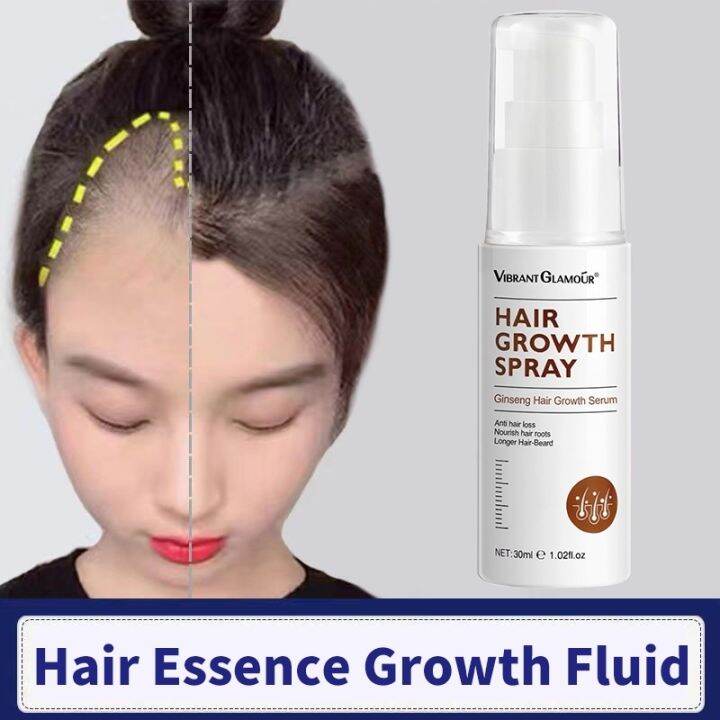 Hair Growth Spray Minoxidil Hair Grower Anti Hair Loss Fast Hair Grower