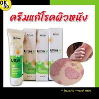 ของแท้/พร้อมส่ง!! [3หลอด] UltraU อัลตร้ายู ครีมโรคผิวหนัง แก้คัน กลากเกลื้อน เชื้อรา ผิวหนังอักเสบ สะเก็ดเงิน หลอดเขียว OK D D