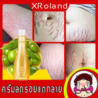 XRoland ครีมกันแตกลาย ช่วยบำรุงและกระชับผิว ซ่อมแซมรอยแตกลายของก่อนคลอดและหลังคลอด（ครีมทารอยแตก,ครีมลดลอยแตกลาย,ครีมแก้ขาลาย,แก้แตกลาย,ครีมลดรอยแตกลาย,แก้แตกลาย,ครีมทาขาลาย,ลดผิวแตกลาย,ครีมแก้แตกลาย,ครีมทาท้องลาย）