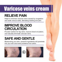 Varicose Vein Soothing Massage Cream Improve Blood Circulation Soothing Leg Cream for Men Women Earthworm Leg Treatment S6-TOP1A-TH