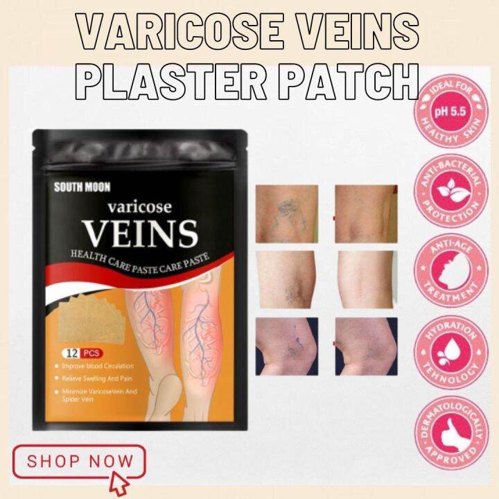 Varicose Veins Plaster Patch 12PCS Pain Relief Smoothes Blood Vessel ...