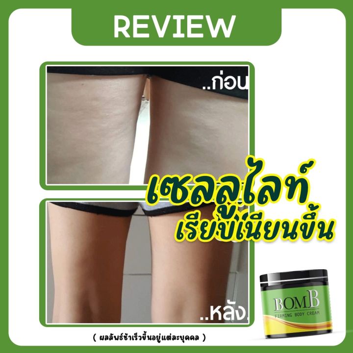 bomb-ครีมสลายไขมัน-ทา-กำจัดส่วนเกิน-เฉพาะส่วน-ลดน้ำหนักลดพุง-ขนาด-100g-1-กระปุก