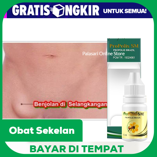 Obat Sekelan Herbal, Uci Uci, Kelenjar Getah Bening, Lipoma, Limfoma ...