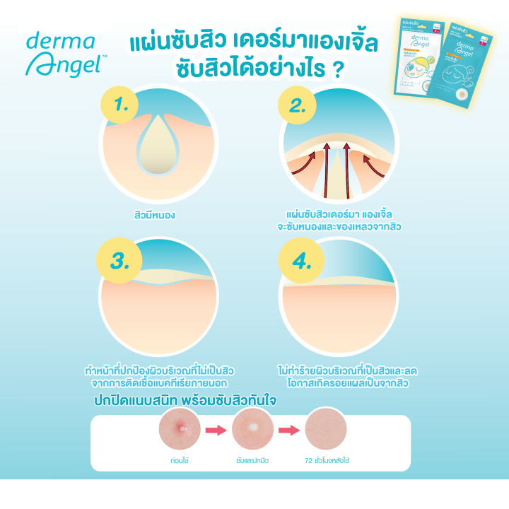 dermaangel-แผ่นดูดสิว-แผ่นแปะสิว-แบบบางพิเศษ-เดอร์มาแองเจิ้ล-สำหรับกลางวัน-18-ชิ้น