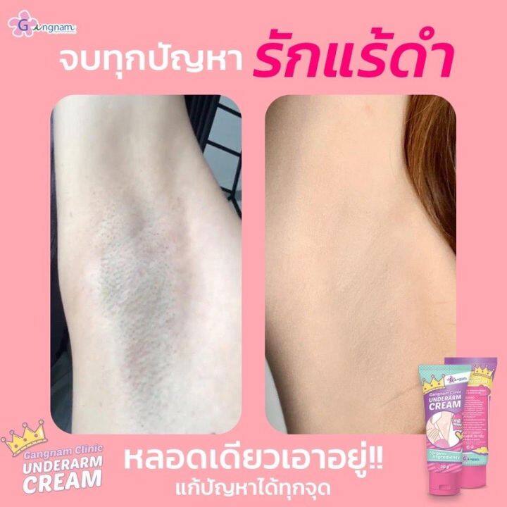 ส่งฟรี-กังนัม-ครีมทารักแร้ขาว-gangnam-underarm-cream-30-g