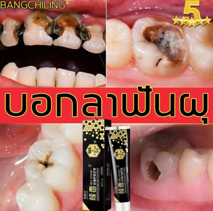 ยาสีฟันพิษผึ้ง-110g-ป้องกันและชะลอฟันผุได้อย่างมีประสิทธิภาพ-ปกป้องเหงือกและฟัน-ลมหายใจสดชื่น-ยาสีฟันไวท์เทนนิ่ง-ยาสีฟัน-ยาสีฟันลดกลิ่นปาก-ยาสีฟันลดกลิ่นปาก-ยาสีฟันดับกลิ่น-ยาสีฟันฟันขาว