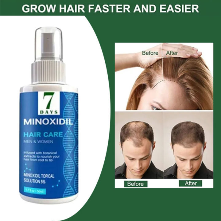 7 Days Hair Grower Serum Faster Long Hair Minoxidil Hair Grower ...