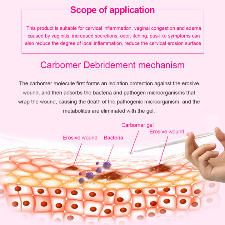 cofoe-เจลรักษาช่องคลอดสำหรับผู้หญิง1กล่อง-carbomer-สำหรับบรรเทาอาการคันครีมป้องกันแบคทีเรียอักเสบทางนรีเวชดูแลจุดซ่อนเร้นเจลกัดเซาะปากมดลูก