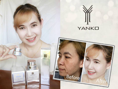 ครีมยันโกะ-yanko-15กรัม-รุ่นสีเงินสูตรผสมทองคำขาว-ของแท้-100