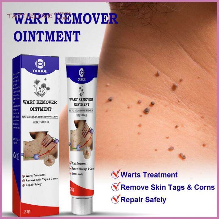 Tattielove Genital Warts Remover Original Cream Herpes Condyloma Skin