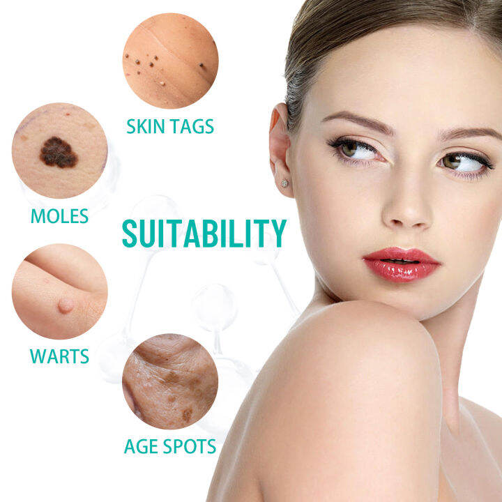 3ml Skin Tag Wart Remover Essence FastActing Corn Removal Essence