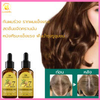 น้ำยาปลูกผม 30ml เซรั่มปลูกผม ช่วยเส้นผมงอกใหม่ได้ ใช้เช้าและเย็น บอกลาหัวล้าน ป้องกันผมร่วง แก้ปัญหาผมร่วงผ（เซรั่มปลูกผม ยาปลูกผมของแท้ น้ำยาเร่งผมยาว เซรั่มใส่ผม เชรั่มปลูกผม เซรั่มเร่งผมยาว ยาสระผมปลูกผม เร่งผมงอกใหม่ สเปรย์ปลูกผม เซรั่มป้องกันผมร่วง）