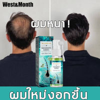 ?สินค้าใหม่?เซรั่มปลูกผม เร่งผมขึ้นใหม่ รักษาผม หยุดผมร่วง ฟื้นฟูผม เซรั่มเร่งผมให้ขึ้นใหม่（สเปรย์ปลูกผม น้ำมันปลูกผม น้ำยาเร่งผมยาว เซรั่มทาผม น้ำปลูกผม ของแท้ ผมหนาขึ้น ผมไม่ร่วง บอกลาผมร่วง ผมบาง Hair Growth ผมร่วง น้ำยาปลูกผมหนา）