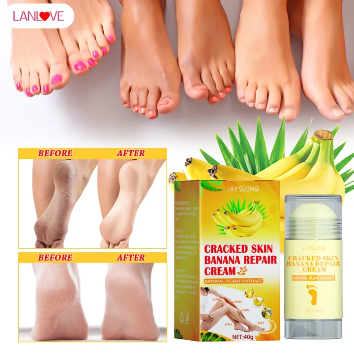 LANLOVE Foot Care Cream Exfoliating Cracked Foot Hand Foot Moisturizing ...