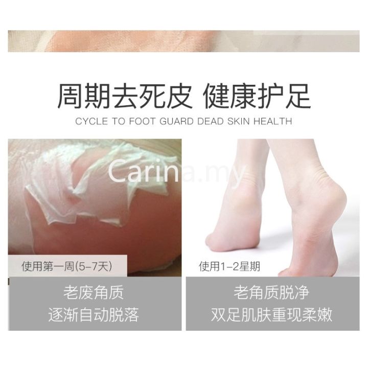 hotready-stock1-pack-milk-bamboo-vinegar-dead-skin-remove-foot-skin-smooth-exfoliating