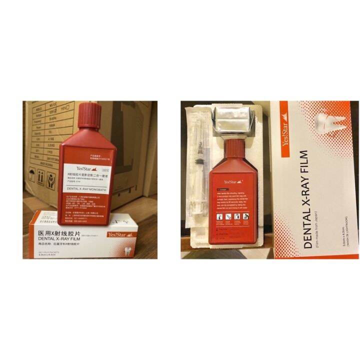 yes star yestar dental xray film 50/100 pieces film & 250ml solution Lazada PH