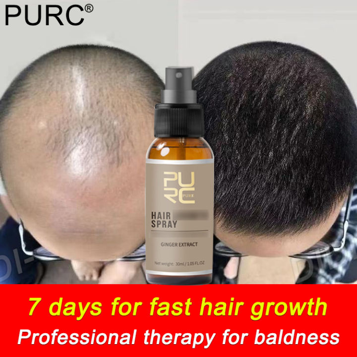 PURC Fast Hair Growth Treatment Essence hair Serum Ginger Essential ...