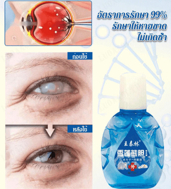 luoaa01-ยาหยอดตาสดใส-ยาหยอดตาต้านความเมื่อยล้า-15ml