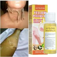 Amotartals Jaysuing 30ML สีเหลือง Peeling Oil Exfoliate Peeling Acid ข้อศอกเข่าทำความสะอาดสำหรับ Skin Whitening