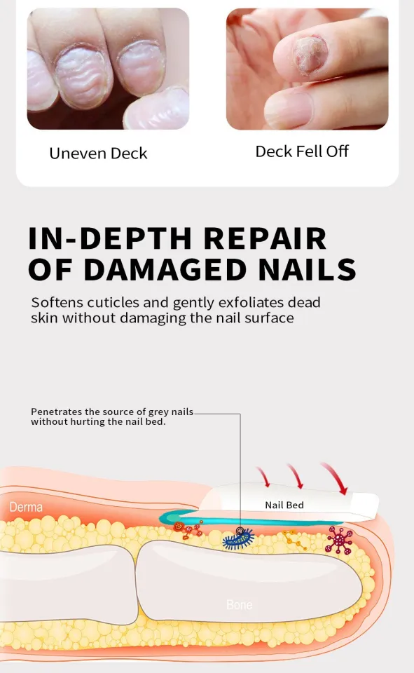 Share 123+ nail care in nursing best songngunhatanh.edu.vn