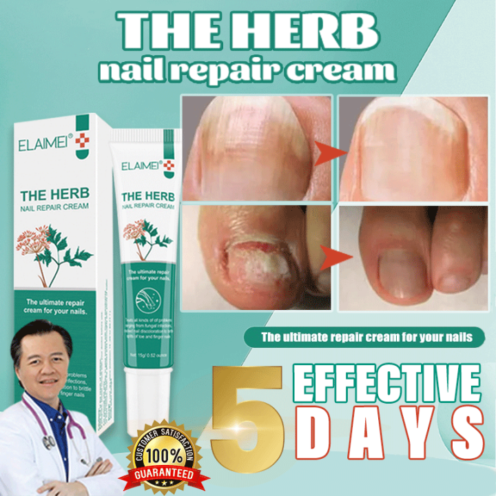 nail treatment fungal nail repair treatment cream care onychomycosis
