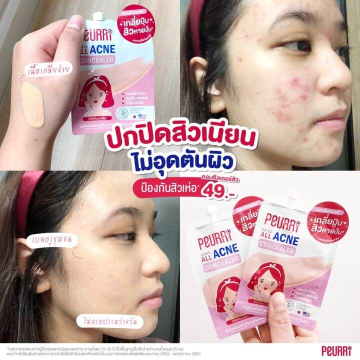 แพ็ค-6-ชิ้น-peurri-cover-all-acne-concealer-คอนซีลเลอร์ปกปิดสิว-รอยสิว-3g