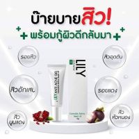 [พร้อมส่ง!!] Lily เจลแต้มสิว Lily anti-acne gel แก้ปัญหา ครบจบ ไอเท็มที่ไม่ควรพลาด