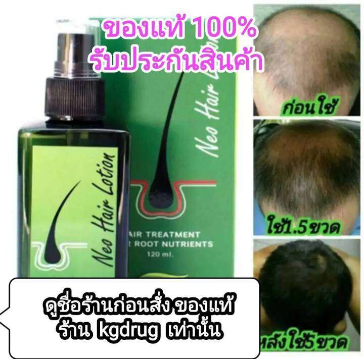 neohair-hair-growth-serum-genuine-from-the-factory