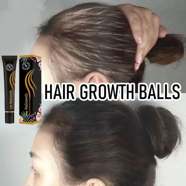 hair treatment castor oil for hair growth hair grower fast long hair hair  grower Thick Hair