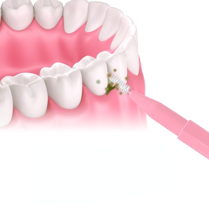 แปรงทันตกรรมฟันปลอมขนาด30ชิ้น-เซ็ตเครื่องมือดูแลช่องปากแปรงฟันทำความสะอาดซอกฟันไหมขัดฟันที่จัดฟันทันตกรรม