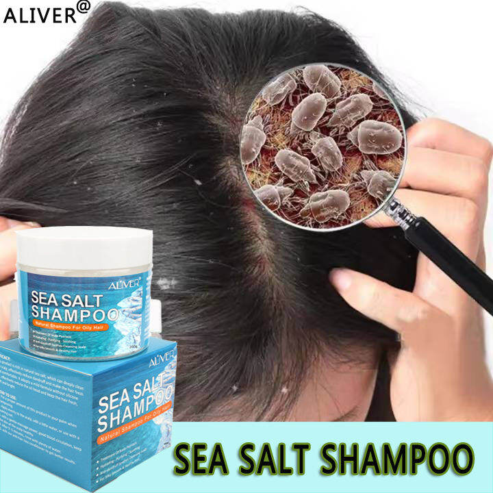 Aliver Sea Salt Shampoo Effectively Solve The Dandruff Itch Soothing