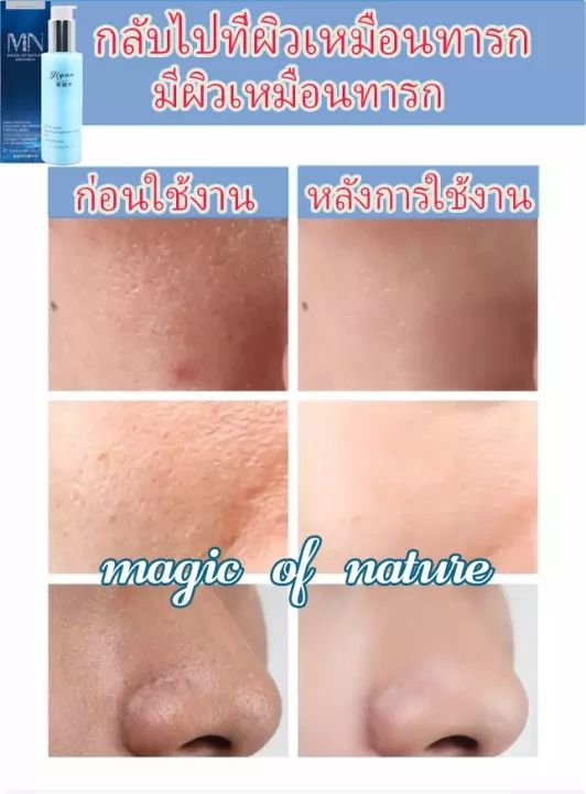 รูขุมขนหดตัวสาระสำคัญ-120ml-ทำให้ผิวขาวขึ้น-เติมเต็มความชุ่มชื้นให้ผิว-เซรั่มหน้าใส-เซรั่มบำรุงผิว-รูขุมขนหดตัว-รูขุมขนกระชับขึ้น-ไวท์เทนนิ่ง-เซรั่มกระชับใบหน้า-กรดไฮยาลูโรนิก-เซรั่มบำรุงผิวหน้า-เซรั่