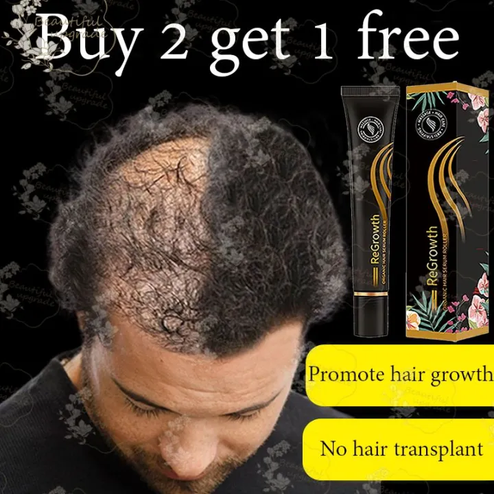 Regrowth Organic Hair Serum Roller Set Hair Care Anti Stripping Liquid 20ml  H2J7 Shopee Thailand | Jinyu Regrowth Hair Serum Roller Hair Loss Treatment  Liquid 