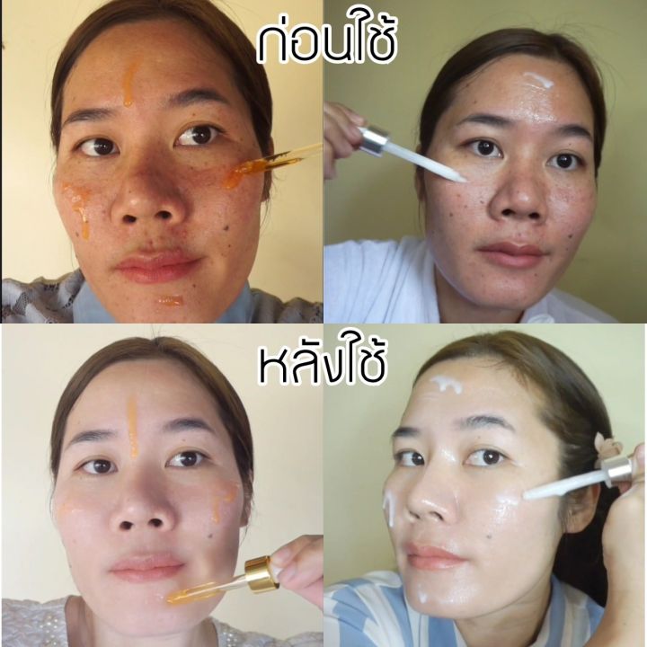 เซรั่มวิตามินซี-spelling