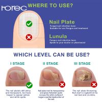 Horec 30ml แก้เชื้อราที่เล็บ บำรุงเล็บ ลากับเล็บเสีย ไม่ทำร้ายเล็บดี ห่างกับปัญหาเล็บ เซรั่มซ่อมแซมเล็บ เซรั่มบำรุงเล็บ ยาใส่เล็บขบ ครีมบำรุงเล็บ ยาบำรุงเล็บ เชื้อราเล็บมือ