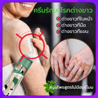 [ส่งเร็ว] ?7วัน เห็นผล?South Moon ครีมทาด่างขาว 20g สารสกัดจากสมุนไพร ไม่ระคายเคือง ใช้ได้ทั้งร่างและทุกวัย ผลิตภัณฑ์กระตุ้นการสร้างเม็ดสีของผิว โรคด่างขาว โรคผิวหนัง ผลิตภัณฑ์ Vitiligo ด่างขาวที่หน้า ด่างขาวที่หลัง ด่างขาวที่แขน ด่างขาวที่ขา ยาด่างขาว