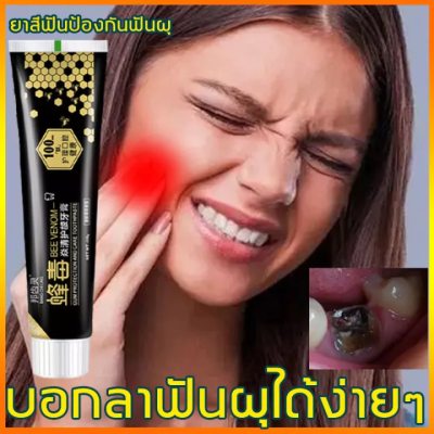 บอกลาอาการปวดฟัน BEE VENOM ยาสีฟัน110g ดูแลสุขภาพช่องปากคุณ ไม่ต้องเป็นห่วงเรื่องเหงือกบวม ฟันผุและแผลในช่องปาก